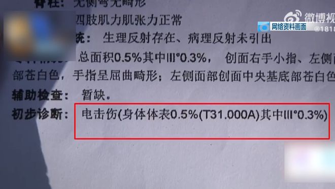 了！5岁儿童爬空调外机瞬间晕厥！人生就是博-尊龙凯时肌腱都打断(图8)